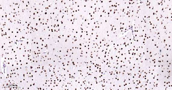 Tar DNA 结合蛋白43即用型免疫组化试剂盒-IHC0429